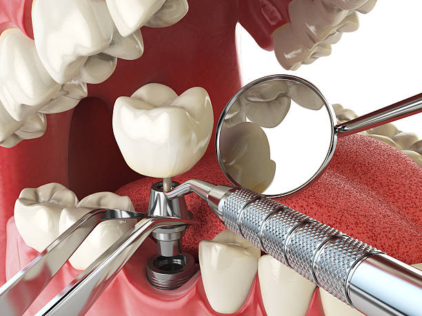 Best Emergency Dentist for Knocked-Out Tooth in Tullahoma, TN